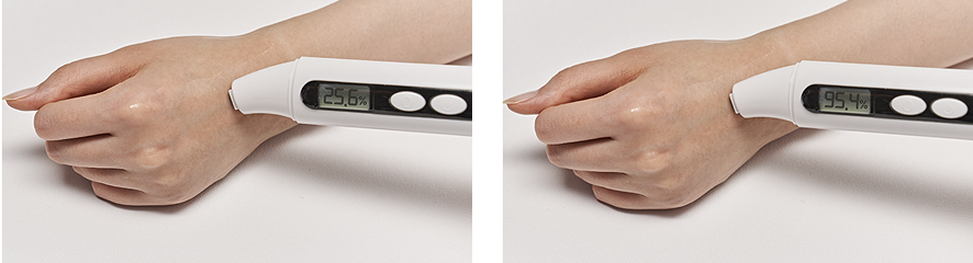 Resultados do tratamento na face